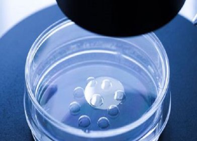 IVF treatment in Bapunagar Ahmedabad